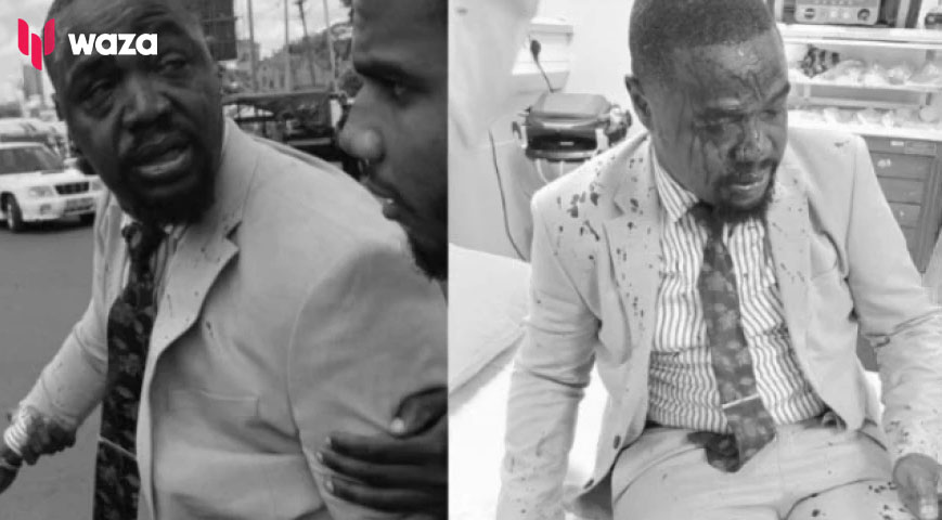 A side-by-side image of KMPDU Secretary General Dr. Davji Atellah after he was shot by police during peaceful protests on February 29, 2024. PHOTOS | COURTESY